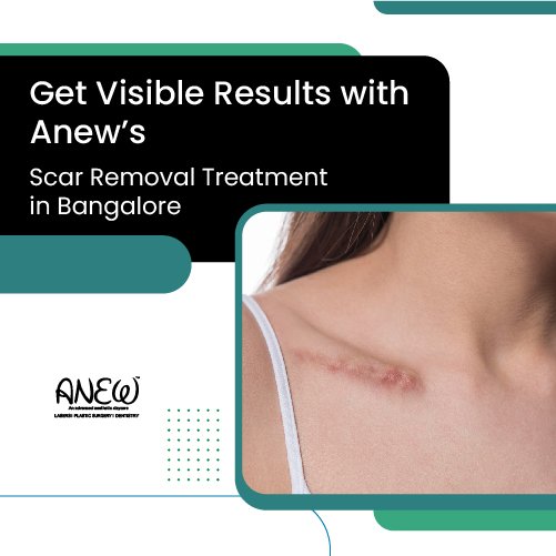 scar removal treatment in bangalore​​